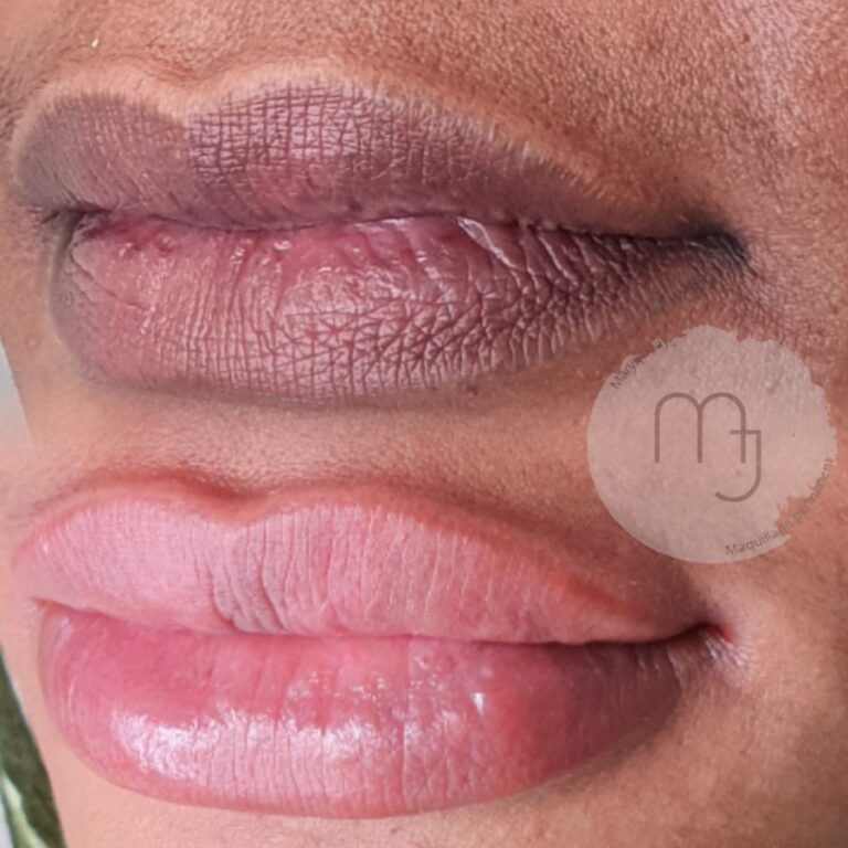 eclaircissement-lèvres-foncèes-femme