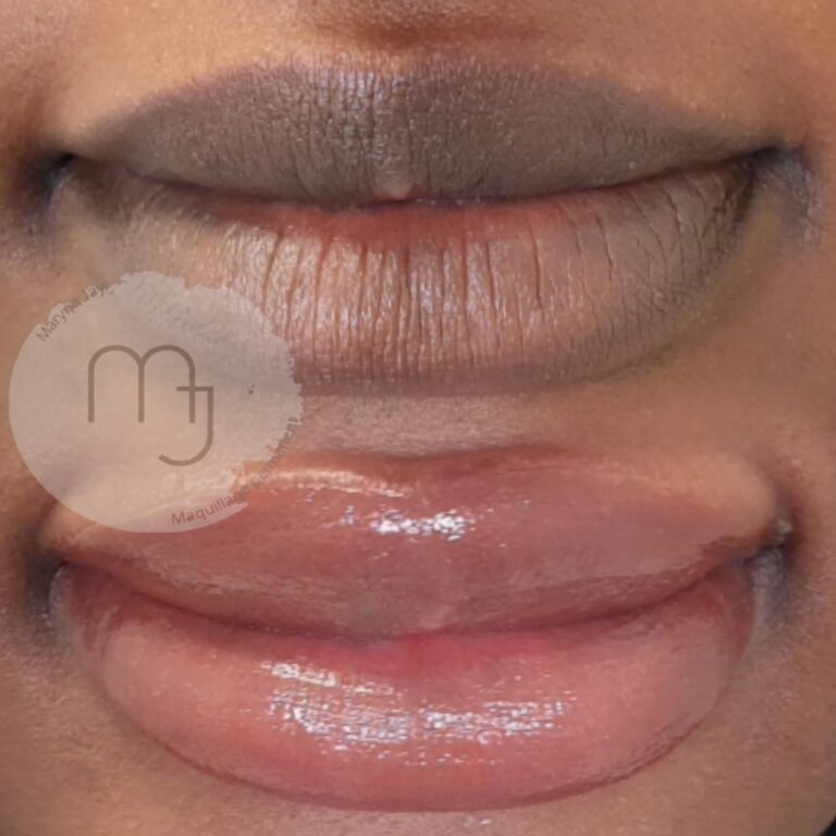 éclaircissement-lèvres-foncées