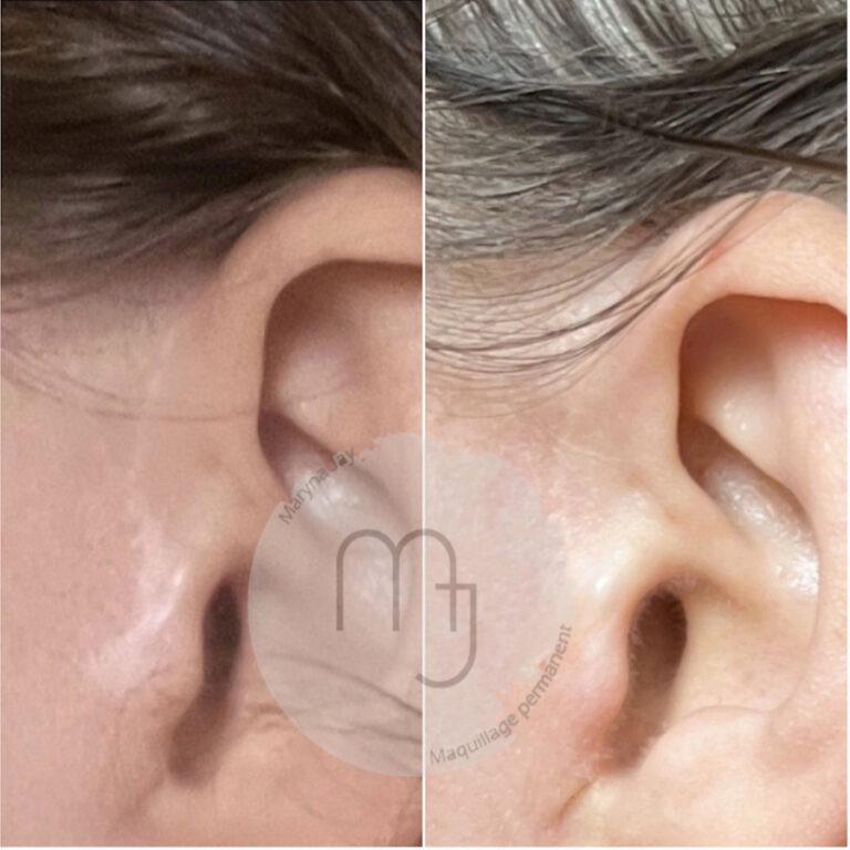 Pigmentation-cuir-chevelu-femme-02