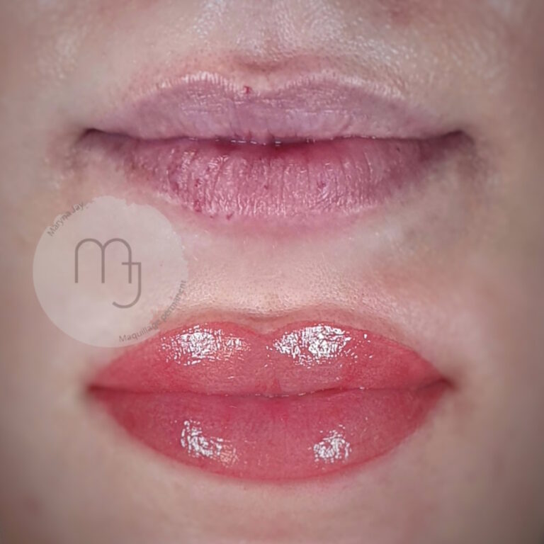 assymetrie-_levres_camouflage_cicatrices