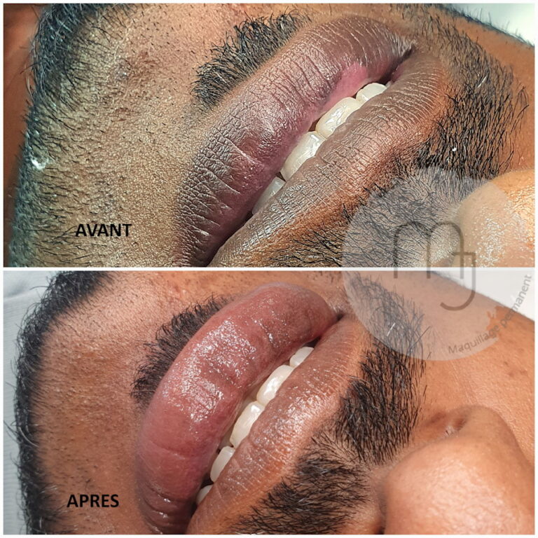 Dermopigmentation-lèvres-homme
