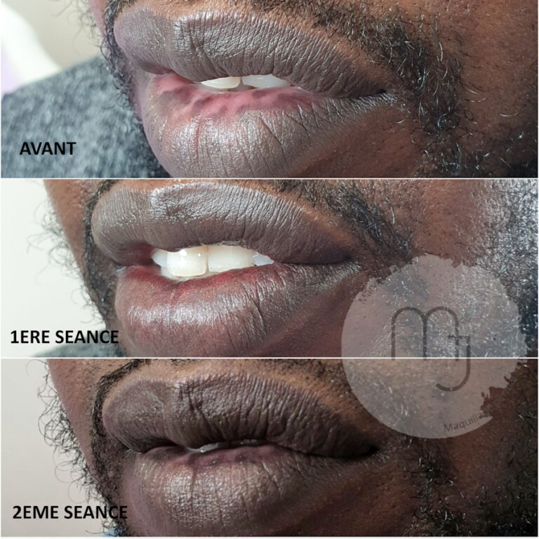 Lèvres-foncées-homme