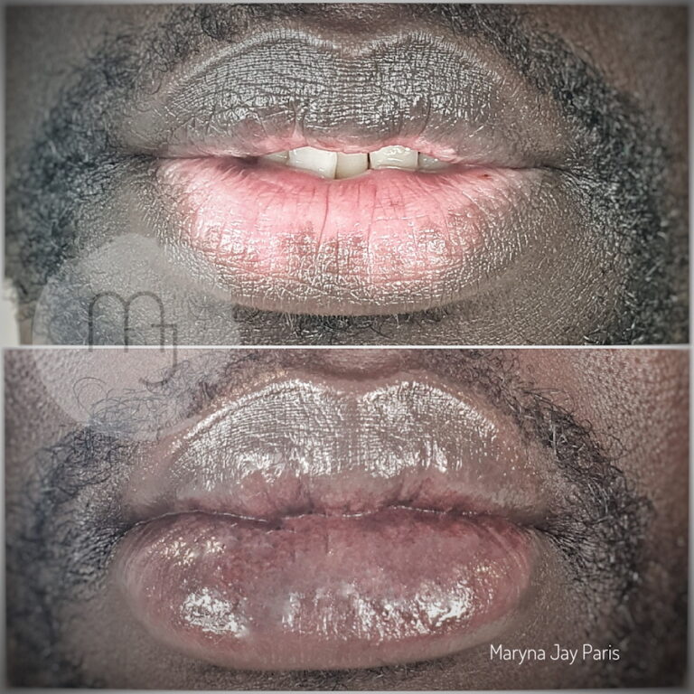lèvres-foncées-homme-maquillage-permanent