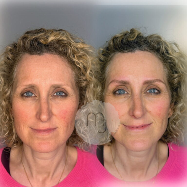 poil-à-poil-sourcils-hyper-réaliste-nanobrows2