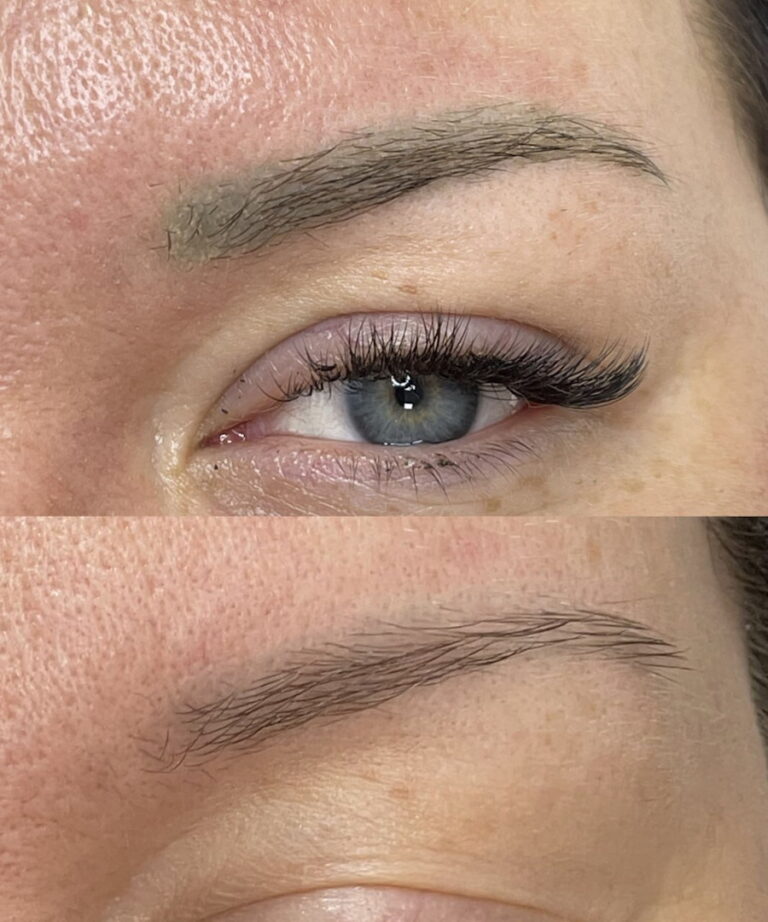 Correction de sourcils gris par détatouage sans laser à Paris