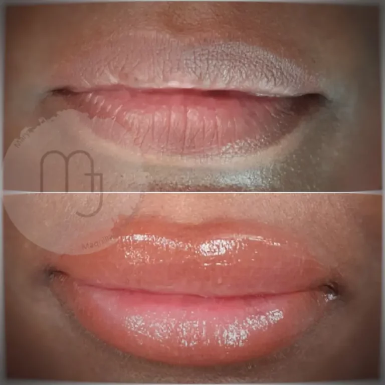 Avant après neutralisation de lèvres foncées avec Dark Lips Balance® par Maryna Jay à Paris