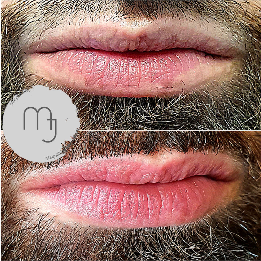 Camouflage-brûlures-Lèvres-homme